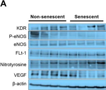 Fig.1.A showing Western Blotting in a Homo sapiens (Human) sample from the publication: Extracellular Vesicles (EVs) Derived from Senescent Endothelial Cells Promote Platelet Activation.