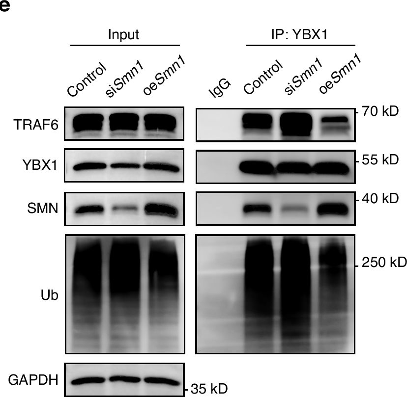 Fig.6.E showing Western Blotting in a Mus musculus (House mouse) sample from the publication: SMN deficiency inhibits endochondral ossification via promoting TRAF6-induced ubiquitination degradation of YBX1 in spinal muscular atrophy.