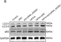 Fig.6.B showing Western Blotting from the publication: Antagonizing circRNA_002581-miR-122-CPEB1 axis alleviates NASH through restoring PTEN-AMPK-mTOR pathway regulated autophagy.