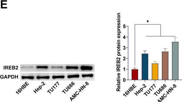 Fig.5.E showing Western Blotting from the publication: Hsa_circYARS interacts with miR-29a-3p to up-regulate IREB2 and promote laryngeal squamous cell carcinoma progression.