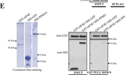 Fig.1.E in a Homo sapiens (Human) sample from the publication: PPM1G dephosphorylates eIF4E in control of mRNA translation and cell proliferation.