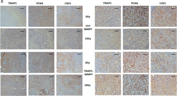 Fig.4.C showing Immunohistochemistry in a Homo sapiens (Human) sample from the publication: Progression-Related Loss of Stromal Caveolin 1 Levels Mediates Radiation Resistance in Prostate Carcinoma via the Apoptosis Inhibitor TRIAP1.