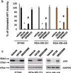 Fig.1.B showing Western Blotting from the publication: Signaling of MK2 sustains robust AP1 activity for triple negative breast cancer tumorigenesis through direct phosphorylation of JAB1.