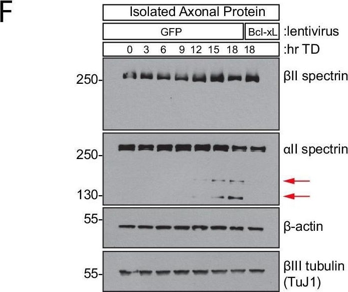 Fig.2.F showing Western Blotting in a Mus musculus (House mouse) sample from the publication: Structural plasticity of actin-spectrin membrane skeleton and functional role of actin and spectrin in axon degeneration.