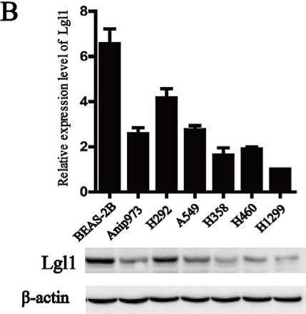 Fig.5.B showing Western Blotting in a Homo sapiens (Human) sample from the publication: MiR-652-3p is upregulated in non-small cell lung cancer and promotes proliferation and metastasis by directly targeting Lgl1.