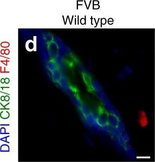 Macrophages orchestrate breast cancer early dissemination and metastasis.