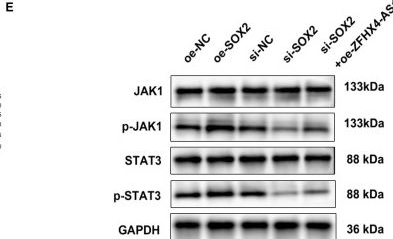 Fig.12.E showing Western Blotting from the publication: LncRNA ZFHX4-AS1 initiates an oncogenic axis involving a ZFHX4/SOX2 positive feedback loop to accelerate glioma progression.