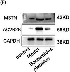 Fig.7.F showing Western Blotting from the publication: Bacteroides plebeius improves muscle wasting in chronic kidney disease by modulating the gut-renal muscle axis.