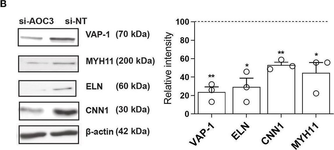 Fig.2.B showing Western Blotting from the publication: Vascular Adhesion Protein-1 Determines the Cellular Properties of Endometrial Pericytes.