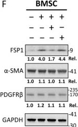 Fig.3.F showing Western Blotting from the publication: Extracellular Enolase-1 Promotes CAF-Associated Stromal Reprogramming via the Plasmin/TGF-β Axis in Multiple Myeloma.