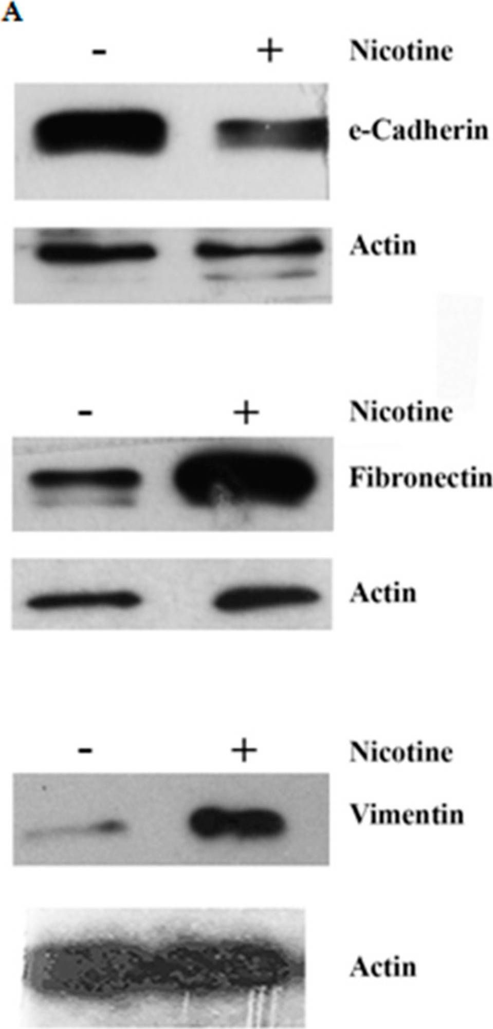 Fig.9.A showing Western Blotting in a Homo sapiens (Human) sample from the publication: Nicotine Changes Airway Epithelial Phenotype and May Increase the SARS-COV-2 Infection Severity.