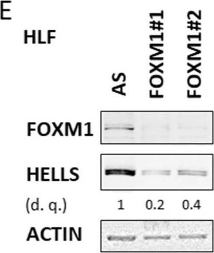 Fig.6.E showing Western Blotting in a Homo sapiens (Human) sample from the publication: HELLS Is Negatively Regulated by Wild-Type P53 in Liver Cancer by a Mechanism Involving P21 and FOXM1.