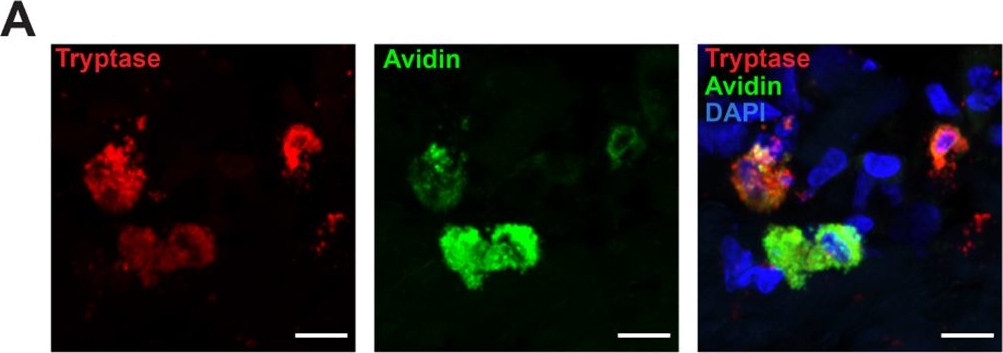 Fig.5.A showing Immunohistochemistry-immunofluorescence in a Homo sapiens (Human) sample from the publication: A mast cell receptor mediates post-stroke brain inflammation via a dural-brain axis.