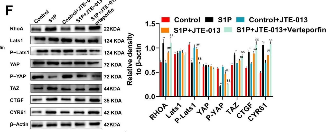 Fig.4.F showing Western Blotting in a Mus musculus (House mouse) sample from the publication: JTE-013 Alleviates Pulmonary Fibrosis by Affecting the RhoA/YAP Pathway and Mitochondrial Fusion/Fission.