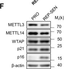 Fig.1.F showing Western Blotting from the publication: PRKN-Mediated Ubiquitin-Proteasome Degradation of METTL3 Promotes Cellular Senescence.