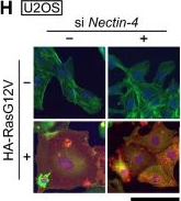Fig.2.H showing Immunocytochemistry-immunofluorescence in a Homo sapiens (Human) sample from the publication: Nectin-4 regulates cellular senescence-associated enlargement of cell size.