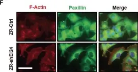 Fig.1.F showing Immunocytochemistry-immunofluorescence from the publication: EI24 regulates epithelial-to-mesenchymal transition and tumor progression by suppressing TRAF2-mediated NF-κB activity.