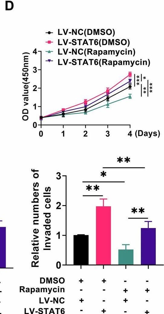 Fig.3.D from the publication: STAT6/LINC01637 axis regulates tumor growth via autophagy and pharmacological targeting STAT6 as a novel strategy for uveal melanoma.