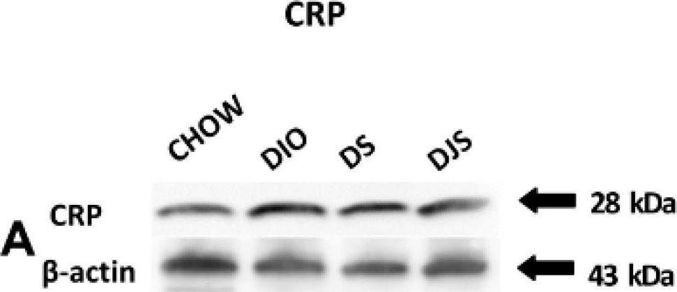 Fig.5.A showing Western Blotting in a Rattus norvegicus (Rat) sample from the publication: Tart Cherry Juice and Seeds Affect Pro-Inflammatory Markers in Visceral Adipose Tissue of High-Fat Diet Obese Rats.