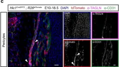Fig.4.C showing Immunofluorescence in a Mus musculus (House mouse) sample from the publication: Cellular taxonomy of Hic1+ mesenchymal progenitor derivatives in the limb: from embryo to adult.