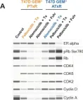 Fig.5.A showing Western Blotting from the publication: Models of Early Resistance to CDK4/6 Inhibitors Unveil Potential Therapeutic Treatment Sequencing.