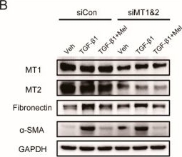 Fig.5.B showing Western Blotting in a Rattus norvegicus (Rat) sample from the publication: Melatonin Prevents Transforming Growth Factor-β1-Stimulated Transdifferentiation of Renal Interstitial Fibroblasts to Myofibroblasts by Suppressing Reactive Oxygen Species-Dependent Mechanisms.