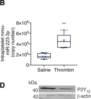 Fig.5.B showing Western Blotting in a Mus musculus (House mouse) sample from the publication: Dicer Neosynthesis Regulates Platelet Reactivity: A Mechanism Altered in Type 2 Diabetes.
