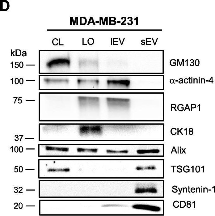 Fig.2.D showing Western Blotting in a Homo sapiens (Human) sample from the publication: Extracellular vesicle-associated tyrosine kinase-like orphan receptors ROR1 and ROR2 promote breast cancer progression.