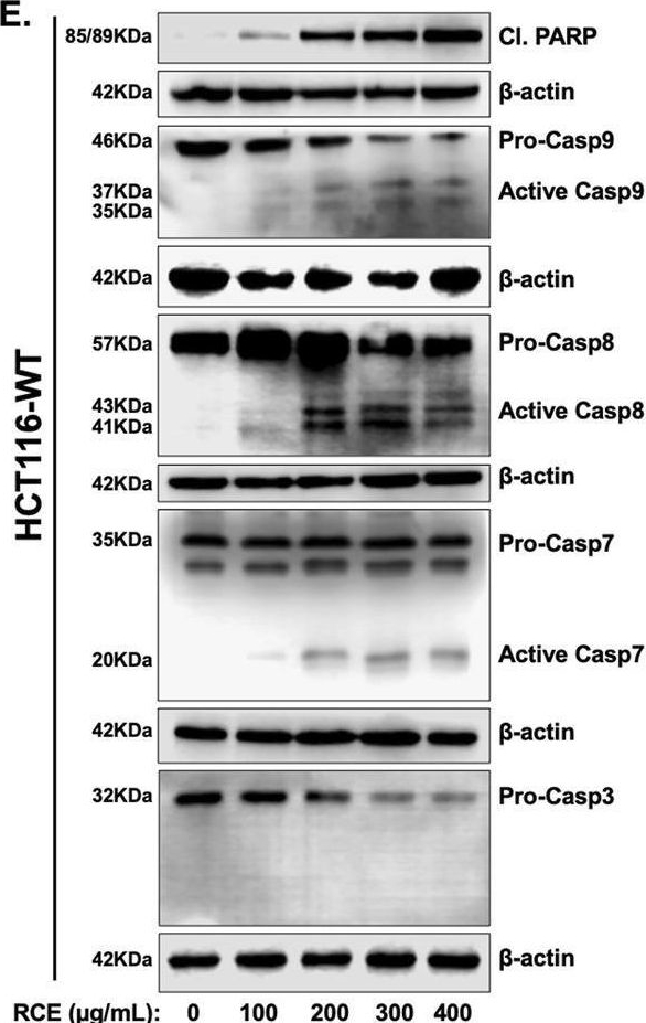 Fig.4.E showing Western Blotting in a Homo sapiens (Human) sample from the publication: Rhus coriaria (Sumac) induces autophagic cell death and inhibits mTOR, p38MAPK and STAT3 pathways in 5fluorouracil-resistant colorectal cancer cells.
