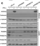 Fig.5.C showing Western Blotting in a Homo sapiens (Human) sample from the publication: Exophagy of annexin A2 via RAB11, RAB8A and RAB27A in IFN-γ-stimulated lung epithelial cells.