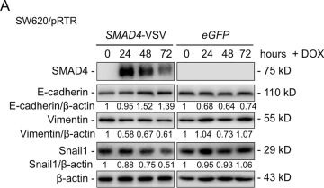Fig.3.A showing Western Blotting from the publication: TGF-β/SMAD4/14-3-3σ/TFEB axis promotes mesenchymal-epithelial transition and inhibits autophagy in colorectal cancer.