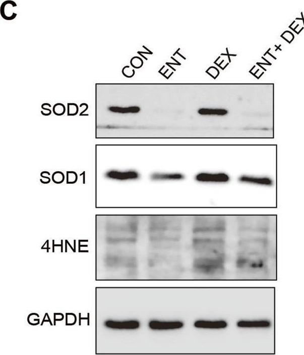 Fig.3.C showing Western Blotting in a Mus musculus (House mouse) sample from the publication: Entacapone alleviates muscle atrophy by modulating oxidative stress, proteolysis, and lipid aggregation in multiple mice models.