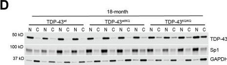 トップス ans dotsloevner TDP43 (D9R3L) Rabbit Monoclonal Antibody | Cell Signaling Technology