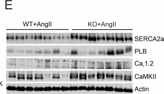 Fig.7.E showing Western Blotting in an Oryctolagus cuniculus (Rabbit) sample from the publication: ATIP1 Is a Suppressor of Cardiac Hypertrophy and Modulates AT2-Dependent Signaling in Cardiac Myocytes.