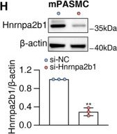 Fig.5.H showing Western Blotting from the publication: Snhg18 promotes hypoxic pulmonary hypertension by enhancing glycolysis.