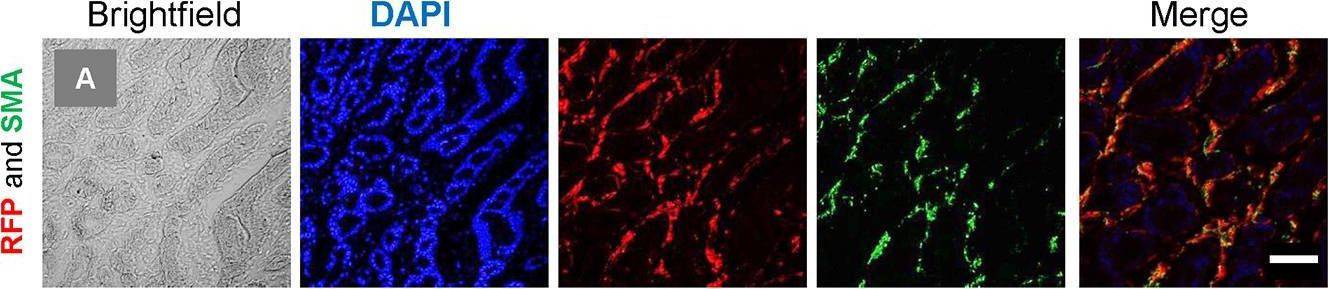The Peutz-Jeghers kinase LKB1 suppresses polyp growth from intestinal cells of a proglucagon-expressing lineage in mice.