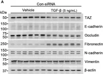Fig.3.A showing Western Blotting in a Homo sapiens (Human) sample from the publication: TAZ is involved in breast cancer cell migration via regulating actin dynamics.