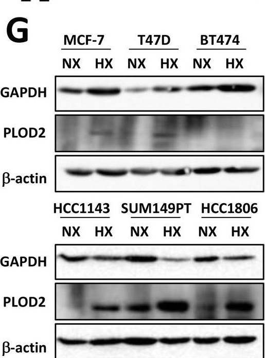 Fig.6.G showing Western Blotting from the publication: Differential response of luminal and basal breast cancer cells to acute and chronic hypoxia.