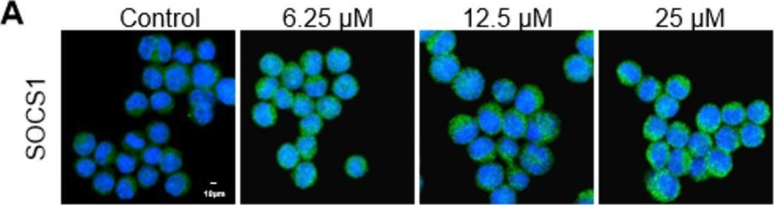 Fig.6.A showing Immunocytochemistry-immunofluorescence in a Mus musculus (House mouse) sample from the publication: Baicalin mitigates alcoholic-associated liver disease via SOCS1-driven reprogramming of macrophages.