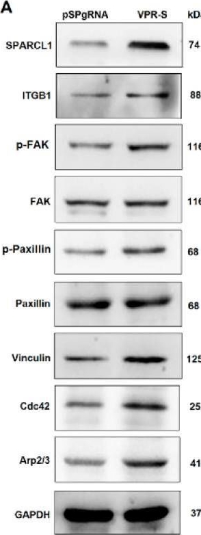 Fig.5.A showing Western Blotting in a Bos taurus (Bovine) sample from the publication: SPARCL1 Influences Bovine Skeletal Muscle-Derived Satellite Cell Migration and Differentiation through an ITGB1-Mediated Signaling Pathway.