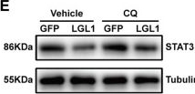 Fig.4.E showing Western Blotting in a Mus musculus (House mouse) sample from the publication: Deletion of Smooth Muscle Lethal Giant Larvae 1 Promotes Neointimal Hyperplasia in Mice.