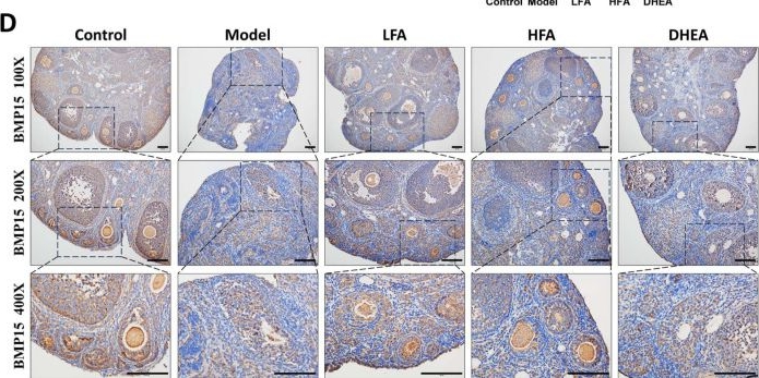 Fig.3.D showing Immunohistochemistry in a Homo sapiens (Human) sample from the publication: Ferulic Acid Alleviates Chemotherapy-Induced POI by Targeting the Grp78 and Perk-eIF2α-ATF4-CHOP Pathway to Attenuate Endoplasmic Reticulum Stress.