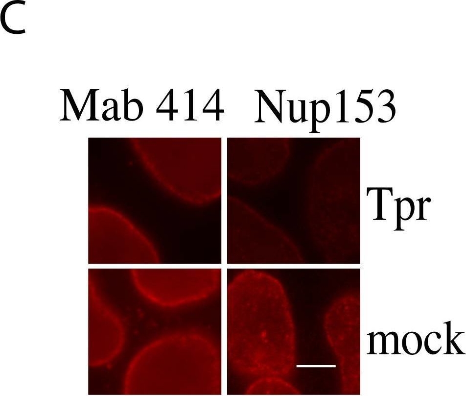 Silencing nuclear pore protein Tpr elicits a senescent-like phenotype in cancer cells.