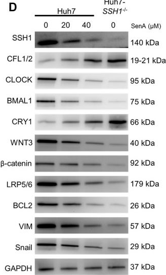 Fig.4.D showing Western Blotting from the publication: Dysregulated expression of slingshot protein phosphatase 1 (SSH1) disrupts circadian rhythm and WNT signaling associated to hepatocellular carcinoma pathogenesis.