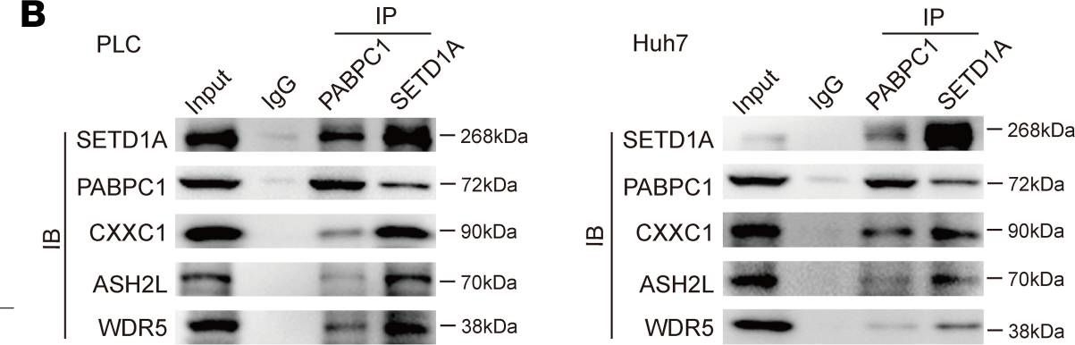 Fig.5.B showing Western Blotting in a Homo sapiens (Human) sample from the publication: SETD1A drives stemness by reprogramming the epigenetic landscape in hepatocellular carcinoma stem cells.