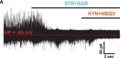 Fig.1.A from the publication: Sparsely Distributed, Pre-synaptic Kv3 K+ Channels Control Spontaneous Firing and Cross-Unit Synchrony via the Regulation of Synaptic Noise in an Auditory Brainstem Circuit.