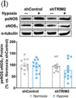 Fig.5.I showing Western Blotting from the publication: TRIM2 Selectively Regulates Inflammation-Driven Pathological Angiogenesis without Affecting Physiological Hypoxia-Mediated Angiogenesis.
