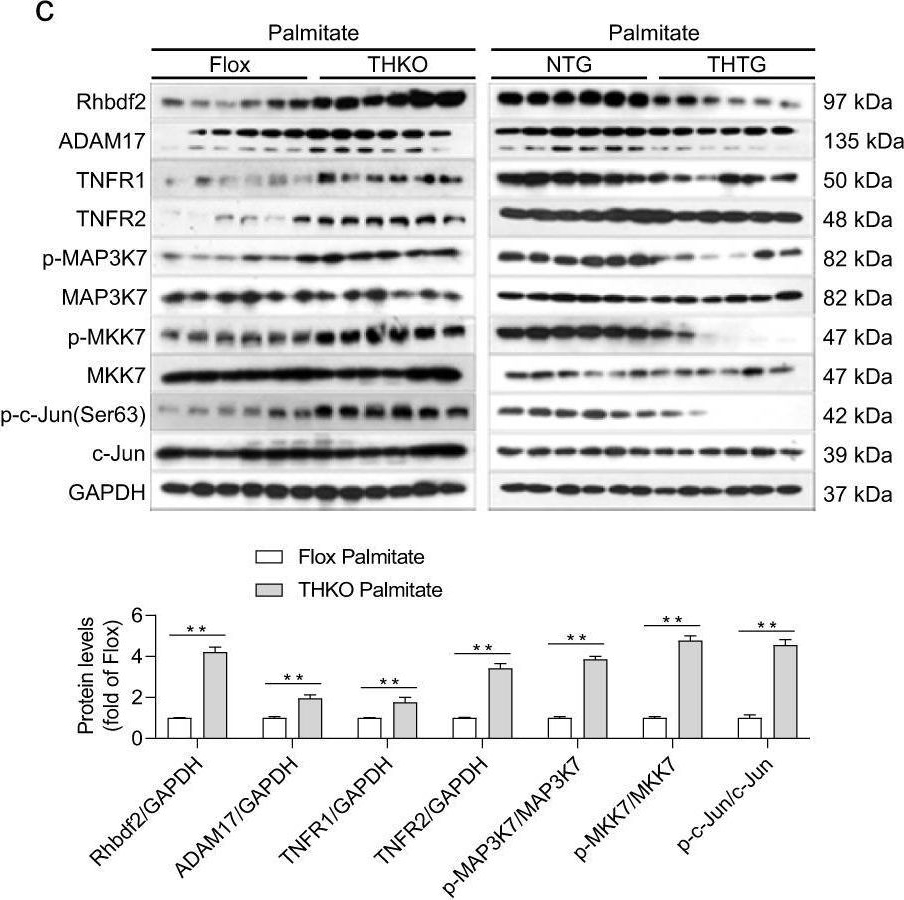 Fig.5.C showing Western Blotting in a Mus musculus (House mouse) sample from the publication: The E3 ubiquitin-protein ligase Trim31 alleviates non-alcoholic fatty liver disease by targeting Rhbdf2 in mouse hepatocytes.