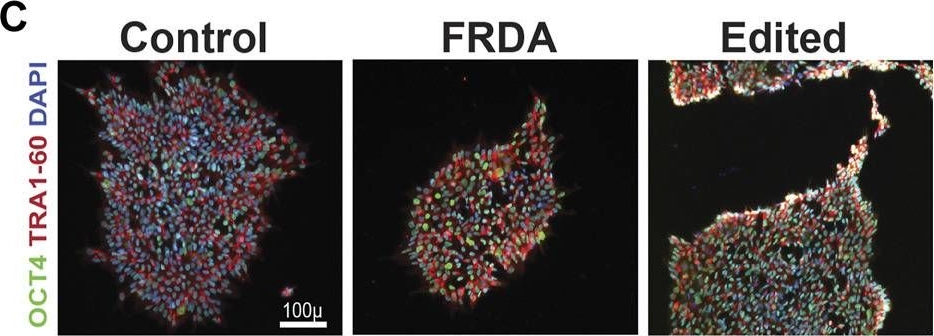 Fig.1.C showing Immunocytochemistry-immunofluorescence in a Homo sapiens (Human) sample from the publication: Gene editing improves endoplasmic reticulum-mitochondrial contacts and unfolded protein response in Friedreich's ataxia iPSC-derived neurons.