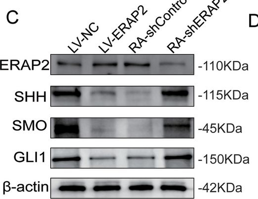 Fig.5.C showing Western Blotting from the publication: Endoplasmic reticulum aminopeptidase 2 regulates CD4+ T cells pyroptosis in rheumatoid arthritis.
